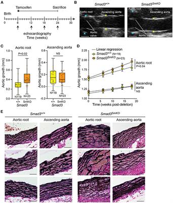 Postnatal Smad3 Inactivation in Murine Smooth Muscle Cells Elicits a Temporally and Regionally Distinct Transcriptional Response